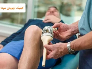 بهترین جراح تعویض مفصل زانو