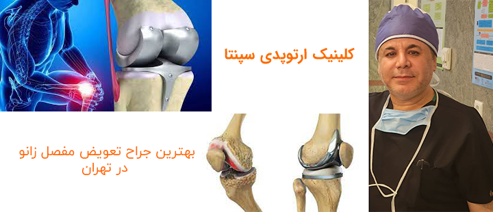 بهترین جراح تعویض مفصل زانو در پونک تهران