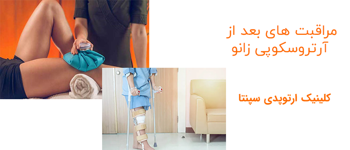 مراقبت های بعد از آرتروسکوپی زانو شامل چه مواردی میشود؟