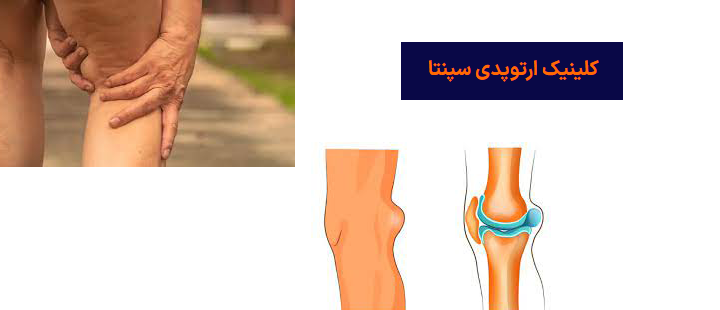 کیست بیکر چیست؟