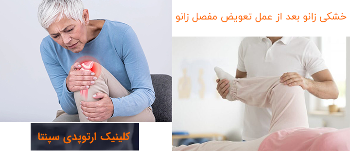 درباره خشکی زانو بعد از عمل تعویض مفصل زانو