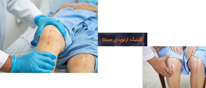آیا درد پس از جراحی تعویض مفصل زانو طبیعی است؟