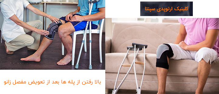 بالا رفتن از پله ها بعد از تعویض مفصل زانو ممکن است؟