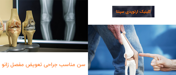 بهترین سن برای جراحی تعویض مفصل زانو