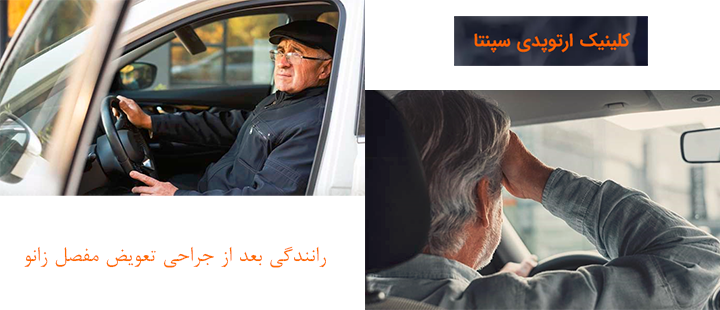 درباره رانندگی بعد از جراحی تعویض مفصل زانو