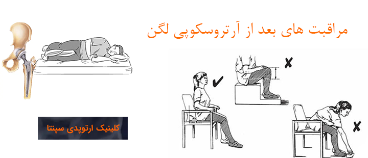 درباره مراقبت های بعد از آرتروسکوپی لگن