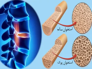 تفسیر سنجش تراکم استخوان