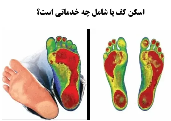 اسکن کف پا چه خدماتی داره