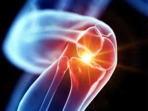 عوارض جراحی آرتروسکوپی زانو، هر آنچه باید قبل از عمل بدانید